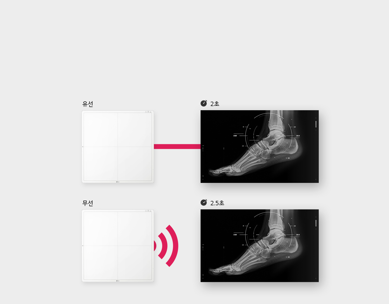이미지는 두 개의 X-ray 사진과 연결된 장치를 보여줍니다. 첫 번째 장치는 유선이라고 표시되어 있으며, X-ray 사진과 연결되어 있습니다. 이 사진에는 발의 뼈 구조가 보이며, 2초라는 시간이 표시되어 있습니다. 두 번째 장치는 무선이라고 표시되어 있으며, X-ray 사진과 연결되어 있습니다. 이 사진에도 발의 뼈 구조가 보이며, 2.5초라는 시간이 표시되어 있습니다.