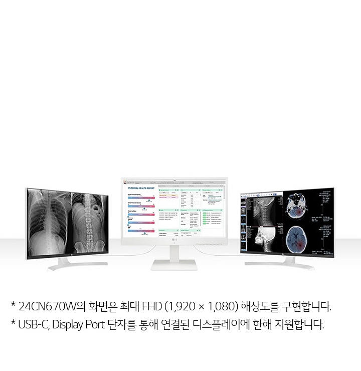 세 개의 모니터가 나란히 배치되어 있습니다. 왼쪽 모니터에는 흉부와 척추의 엑스레이 이미지가 표시되어 있습니다. 가운데 모니터에는 'PERSONAL HEALTH REPORT'라는 제목의 건강 보고서가 표시되어 있으며, 다양한 건강 관련 수치와 정보가 나열되어 있습니다. 오른쪽 모니터에는 두개골과 뇌의 CT 스캔 이미지가 보입니다. 이미지 하단에는 24CN670W의 화면은 최대 FHD (1,920 x 1,080) 해상도를 구현합니다. USB-C, Display Port 단자를 통해 연결된 디스플레이에 한해 지원합니다.라는 텍스트가 있습니다.