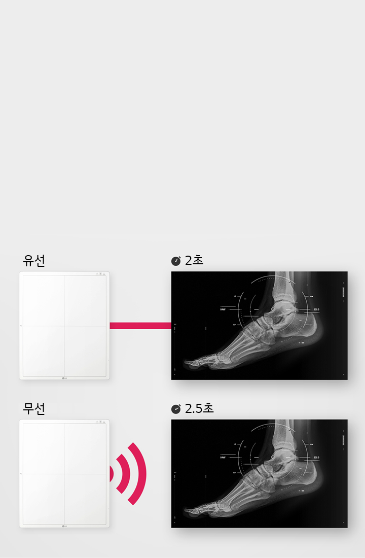이미지는 두 개의 X-ray 사진과 연결된 장치를 보여줍니다. 첫 번째 장치는 유선이라고 표시되어 있으며, X-ray 사진과 연결되어 있습니다. 이 사진에는 발의 뼈 구조가 보이며, 2초라는 시간이 표시되어 있습니다. 두 번째 장치는 무선이라고 표시되어 있으며, X-ray 사진과 연결되어 있습니다. 이 사진에도 발의 뼈 구조가 보이며, 2.5초라는 시간이 표시되어 있습니다.