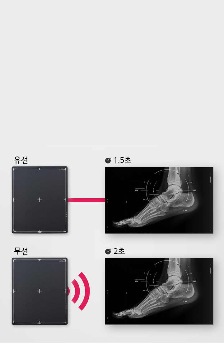 이미지는 두 개의 X-ray 패널을 보여줍니다. 첫 번째 패널은 유선이라고 표시되어 있으며, 빨간색 선으로 연결되어 있는 X-ray 이미지가 있습니다. 이 이미지에는 1.5초라는 텍스트가 포함되어 있습니다. 두 번째 패널은 무선이라고 표시되어 있으며, 무선 신호 아이콘이 옆에 있습니다. 이와 연결된 X-ray 이미지에는 2초라는 텍스트가 포함되어 있습니다. 두 X-ray 이미지 모두 발의 뼈 구조를 보여주고 있습니다.