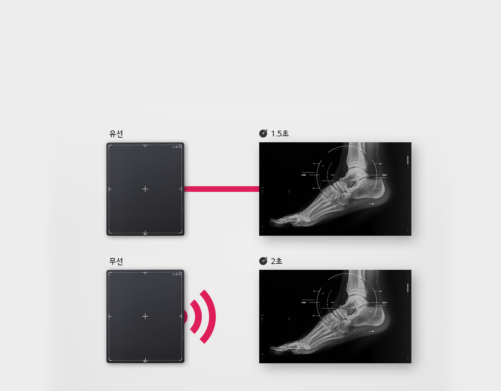 이미지는 두 개의 X-ray 패널을 보여줍니다. 첫 번째 패널은 유선이라고 표시되어 있으며, 빨간색 선으로 연결되어 있는 X-ray 이미지가 있습니다. 이 이미지에는 1.5초라는 텍스트가 포함되어 있습니다. 두 번째 패널은 무선이라고 표시되어 있으며, 무선 신호 아이콘이 옆에 있습니다. 이와 연결된 X-ray 이미지에는 2초라는 텍스트가 포함되어 있습니다. 두 X-ray 이미지 모두 발의 뼈 구조를 보여주고 있습니다.