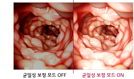 두 개의 내시경 이미지가 나란히 배치되어 있으며, 왼쪽 이미지는 균일성 보정 모드 OFF라고 표시되어 있고, 오른쪽 이미지는 균일성 보정 모드 ON이라고 표시되어 있습니다. 두 이미지 모두 장 내부를 보여주고 있으며, 조명과 색감의 차이가 있습니다.