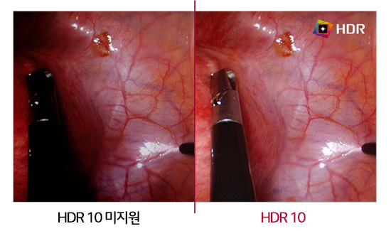 이미지는 두 개의 비교 사진으로 구성되어 있으며, 왼쪽 사진은 HDR 10 미지원이라는 텍스트가 있고, 오른쪽 사진은 HDR 10이라는 텍스트가 있습니다. 두 사진 모두 내부 장기의 세부 구조를 보여주며, HDR 10이 적용된 오른쪽 사진이 더 선명하고 색상이 풍부하게 표현되어 있습니다. HDR 로고가 오른쪽 사진의 상단에 표시되어 있습니다.