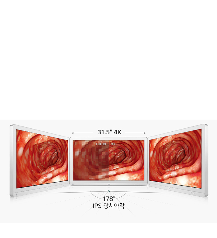 세 개의 모니터가 나란히 배치되어 있으며, 각각의 화면에는 내시경으로 촬영한 듯한 내부 장기의 이미지가 표시되어 있습니다. 가운데 모니터에는 Full HD와 4K라는 텍스트가 있으며, 화면의 해상도를 비교하는 듯한 이미지가 나타나 있습니다. 모니터 위에는 31.5” 4K라는 텍스트가 있고, 아래에는 178° IPS 광시야각이라는 텍스트가 있습니다.