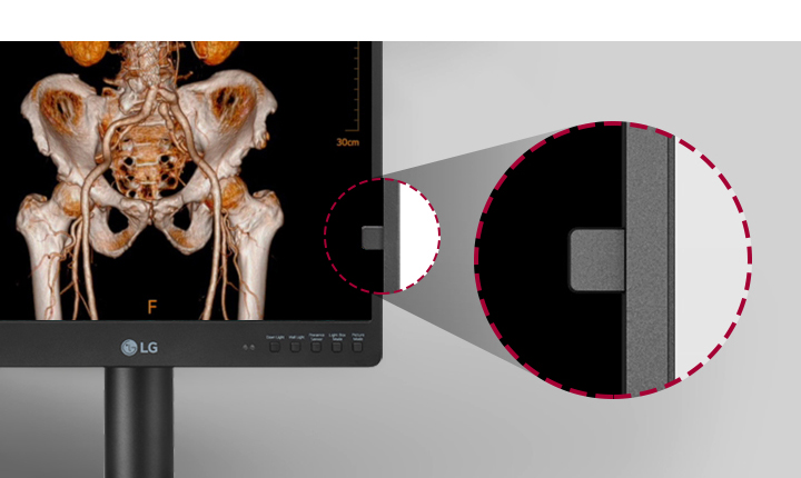 LG 모니터 화면에 인체의 뼈 구조가 3D 이미지로 표시되어 있습니다. 화면의 측면 부분이 확대되어 있으며, 모니터 하단에는 LG 로고와 함께 여러 개의 버튼이 보입니다. 배경은 회색입니다.