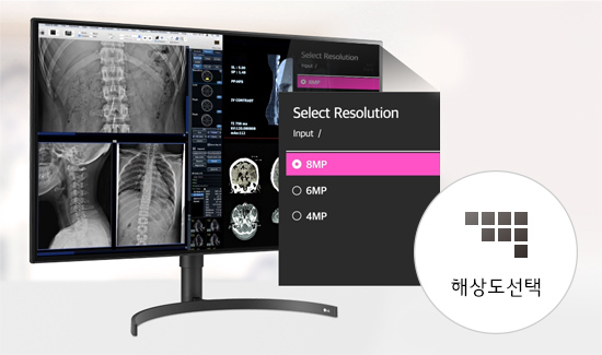 모니터 화면에 척추와 두개골의 X-ray 이미지가 표시되어 있습니다. 화면 오른쪽에는 'Select Resolution'이라는 메뉴가 있으며, '8MP', '6MP', '4MP' 옵션 중 '8MP'가 선택되어 있습니다. 모니터 아래에는 '해상도 선택'이라는 텍스트가 포함된 원형 아이콘이 있습니다.