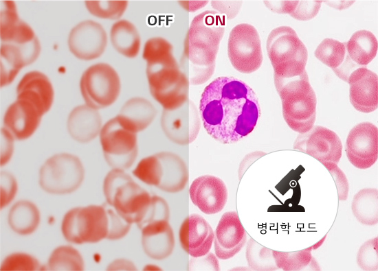 이미지는 두 부분으로 나뉘어 있으며, 왼쪽은 흐릿한 적혈구 이미지와 OFF라는 텍스트가 있습니다. 오른쪽은 선명한 적혈구 이미지와 함께 보라색으로 염색된 세포가 보이며, ON이라는 텍스트가 있습니다. 오른쪽 하단에는 현미경 아이콘과 함께 병리학 모드라는 텍스트가 포함되어 있습니다.