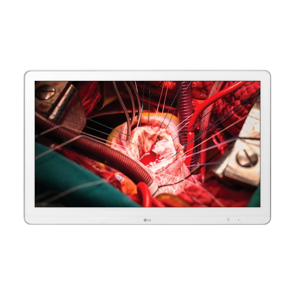 모니터 LG 의료용 디바이스 (의료용 영상 출력기) (27HK510SW.BKR) 메인이미지 0